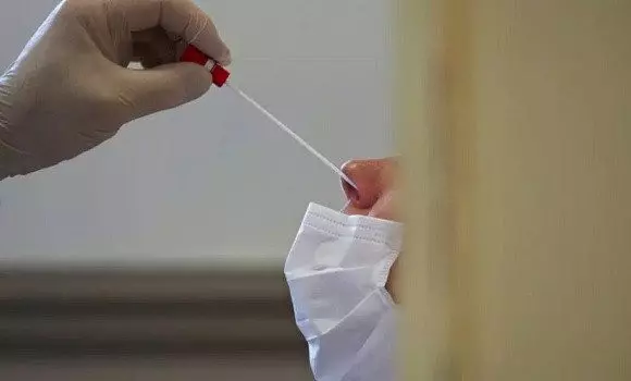 Coronavirus Algérie : Réduction des prix des Scanners et des tests PCR