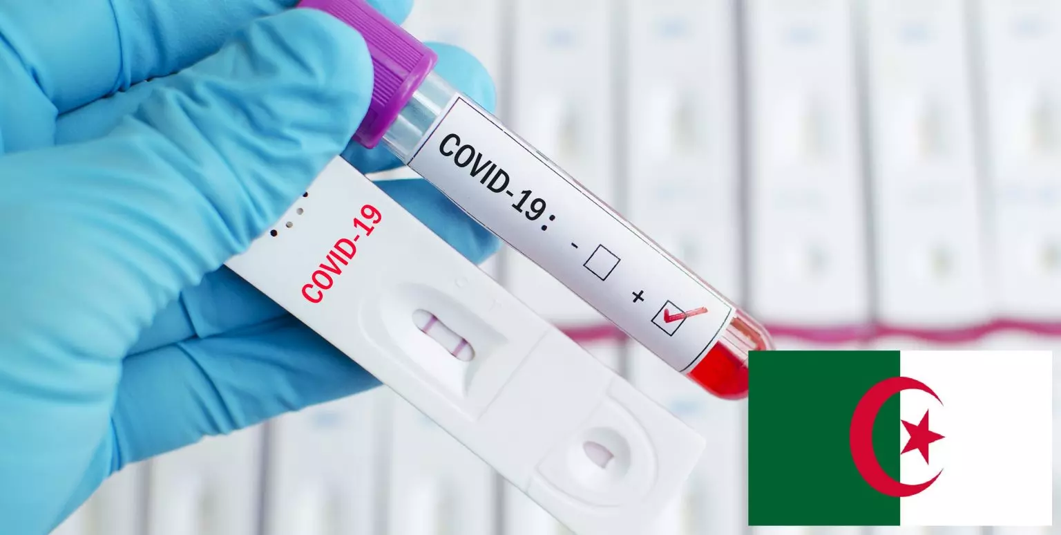 Le ministère de la santé publie la liste des laboratoires effectuant les tests PCR à 8800 Dzd