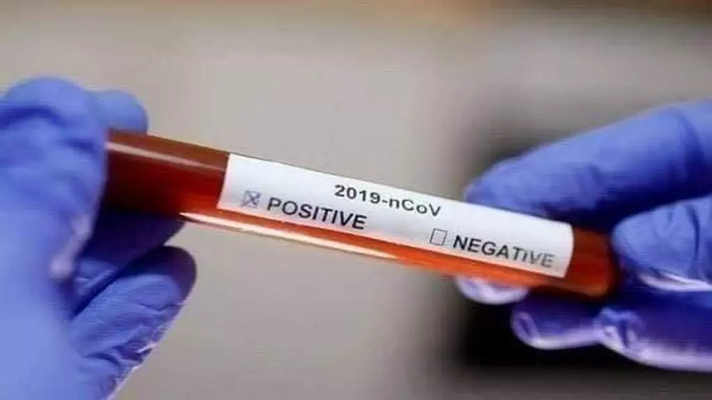 Bilans coronavirus Algérie : les tests antigéniques pris en compte