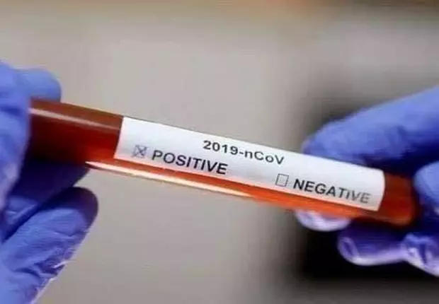 Bilans coronavirus Algérie : les tests antigéniques pris en compte