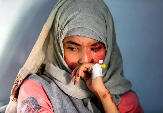 L’histoire d’Al-Anoud illustre la maltraitance des femmes au Yémen