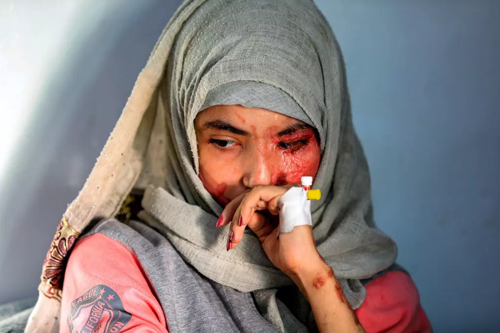 L’histoire d’Al-Anoud illustre la maltraitance des femmes au Yémen