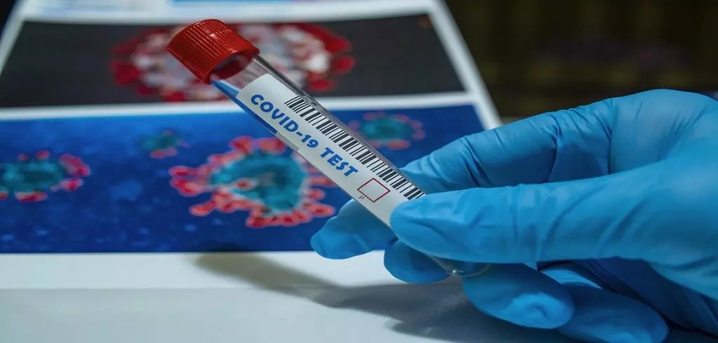 Covid-19 en Algérie : Un bilan qui continue sa hausse