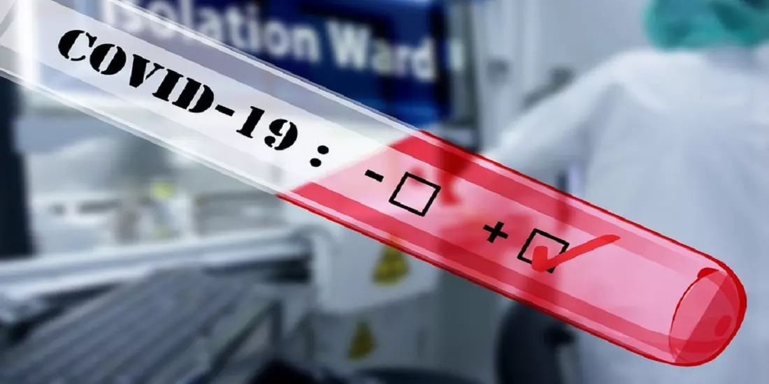 Covid-19 en Algérie : Un bilan en forte baisse ce 20 mars