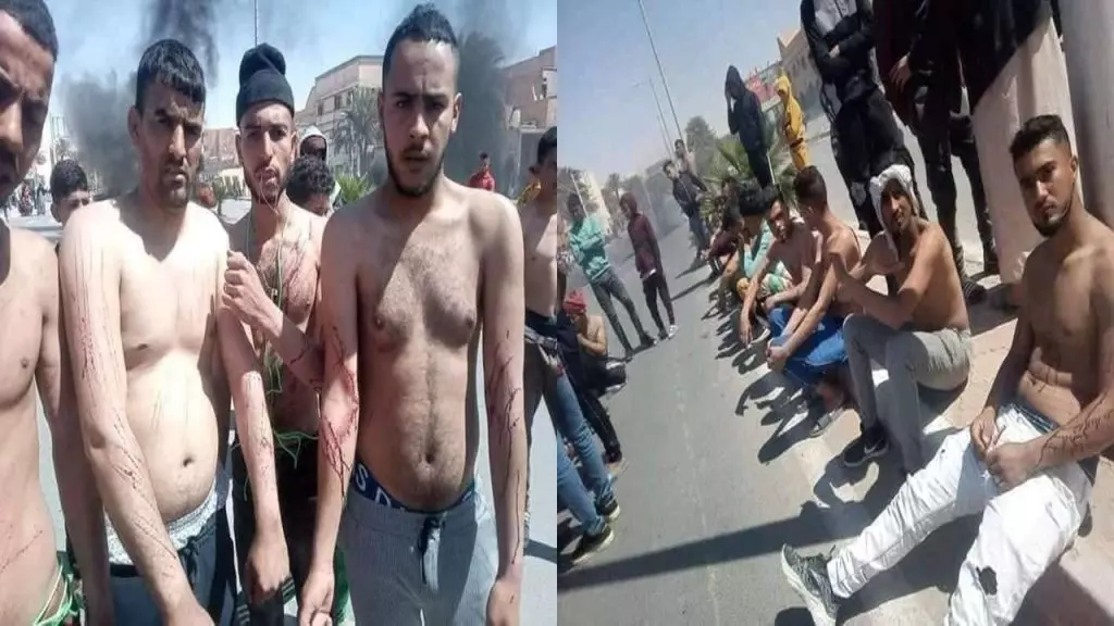 Ouargla : Les jeunes protestataires s&rsquo;automutilent