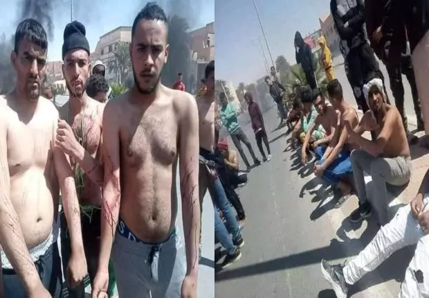 Ouargla : Les jeunes protestataires s&rsquo;automutilent