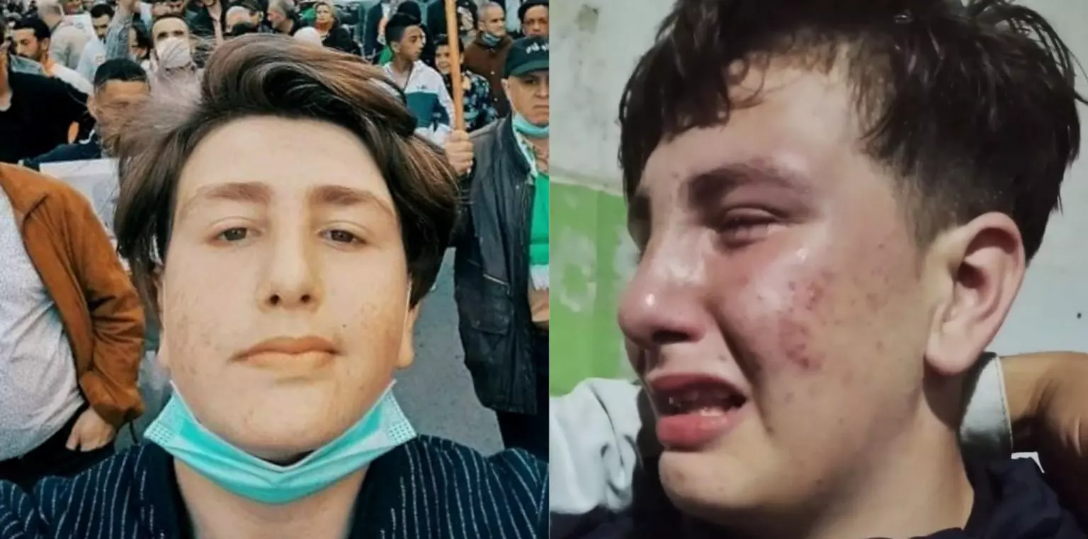 Alger : Un mineur victime d’“attouchements sexuels” par des policiers