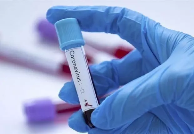 Covid-19 en Algérie : Une courbe qui repart à la hausse