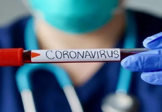 Covid-19 en Algérie: Le bilan à nouveau sous la barre des 100 cas