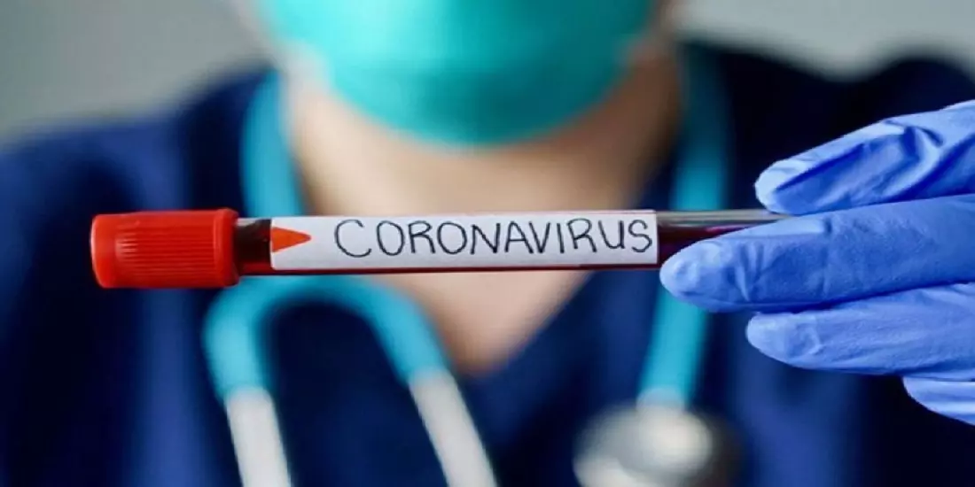 Covid-19 en Algérie: Le bilan à nouveau sous la barre des 100 cas