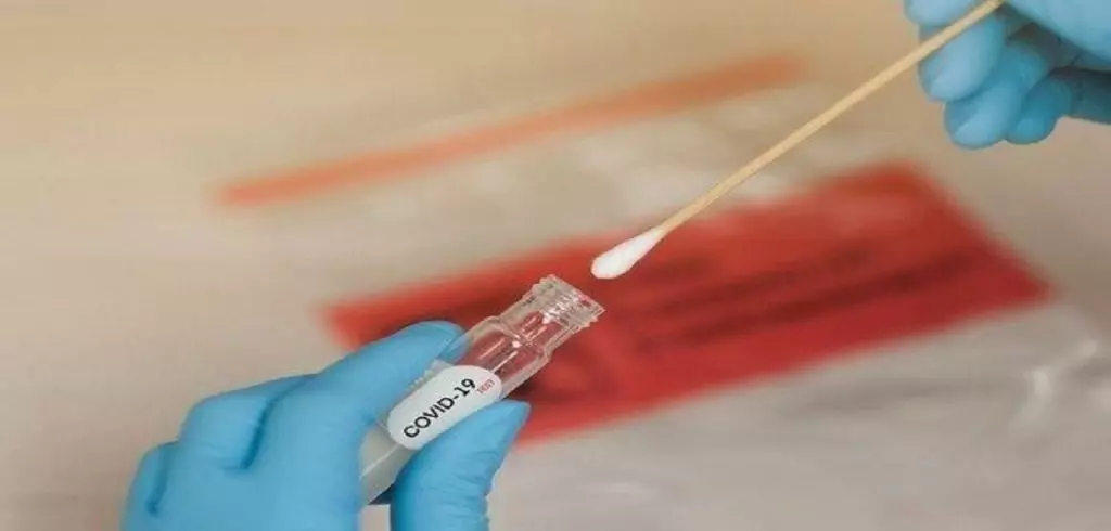 Covid-19 en Algérie : Un bilan qui repart à la hausse