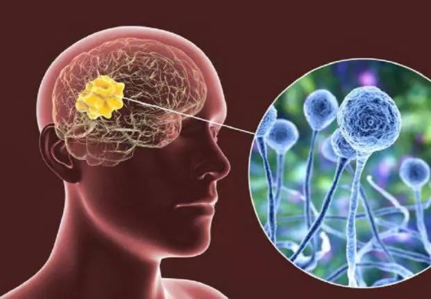 Après le noir, un nouveau champignon mortel menace l’Inde