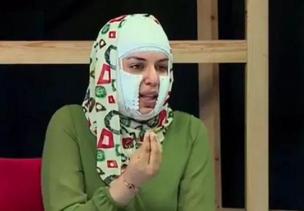 Féminicides en Algérie : poignant témoignage d’une rescapée