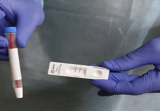 Covid-19 en Algérie : les prix des tests de dépistage flambent