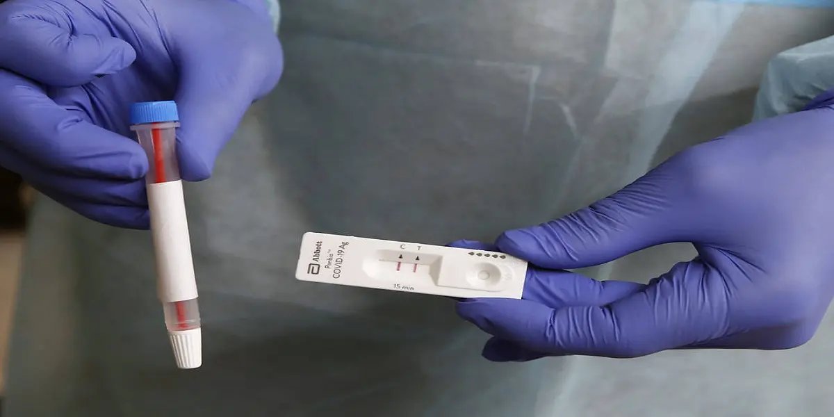 Covid-19 en Algérie : les prix des tests de dépistage flambent