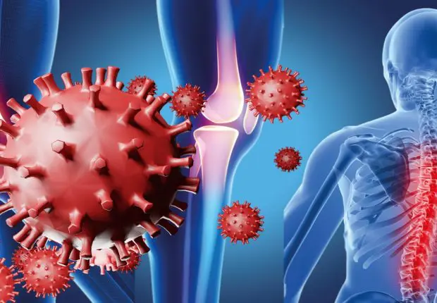 Covid-19 et maladies orthopédiques : une spécialiste explique le lien