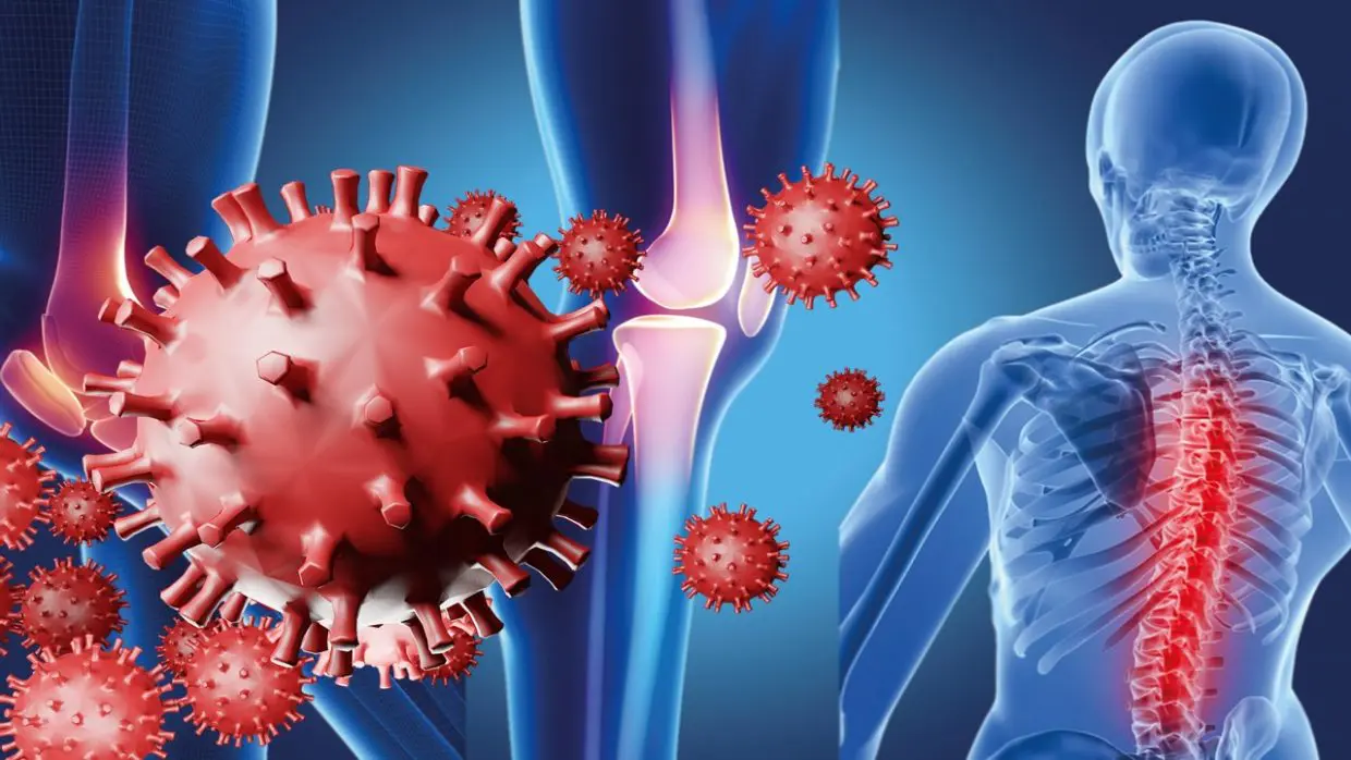Covid-19 et maladies orthopédiques : une spécialiste explique le lien