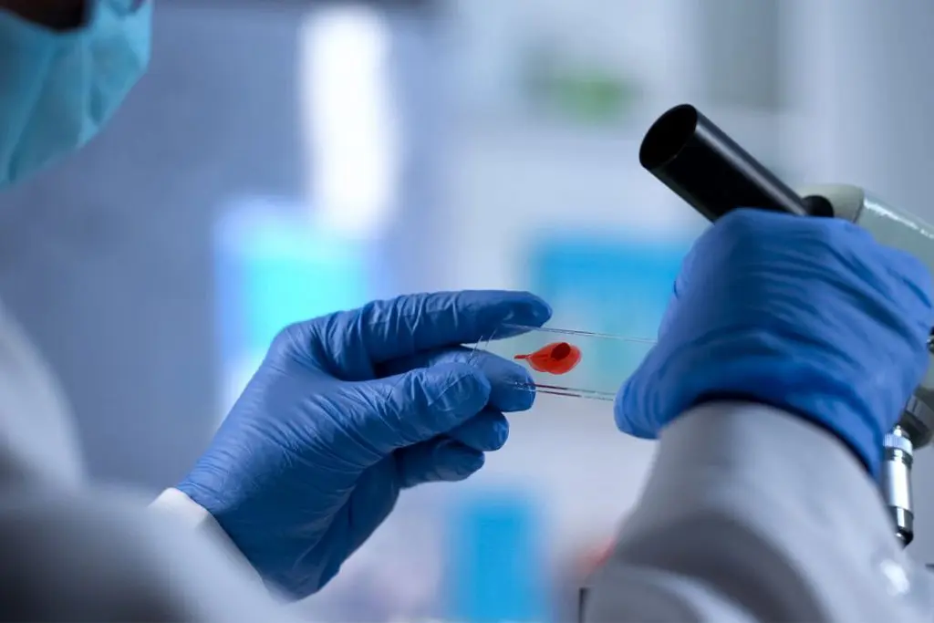 Covid-19 : quel est le lien entre le variant Omicron et le SIDA ?