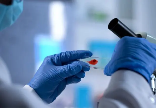 Covid-19 : quel est le lien entre le variant Omicron et le SIDA ?