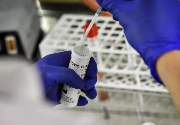 Covid-19 en France : un nouveau variant découvert dans le sud