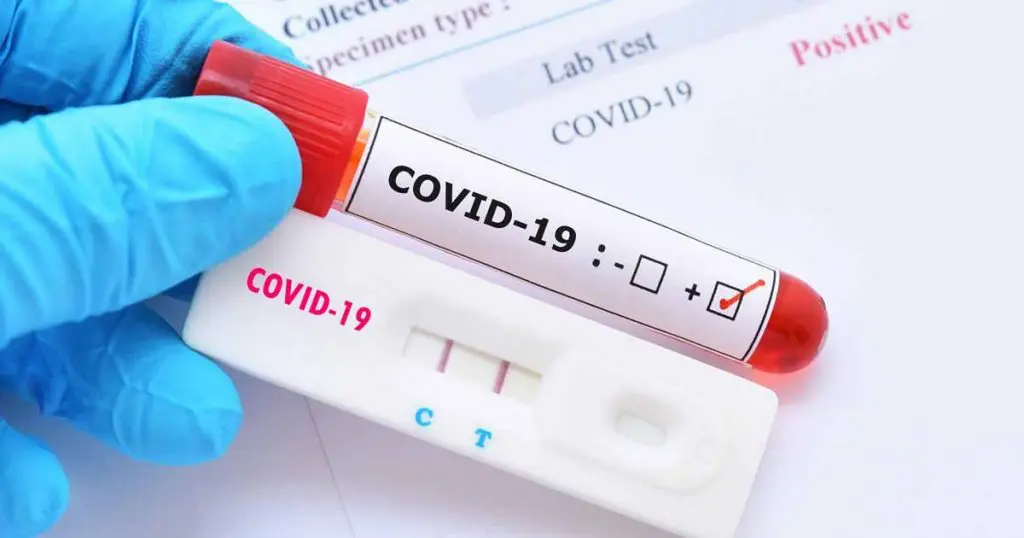Covid-19 en Algérie : nombre de cas en légère hausse ce 29 juin