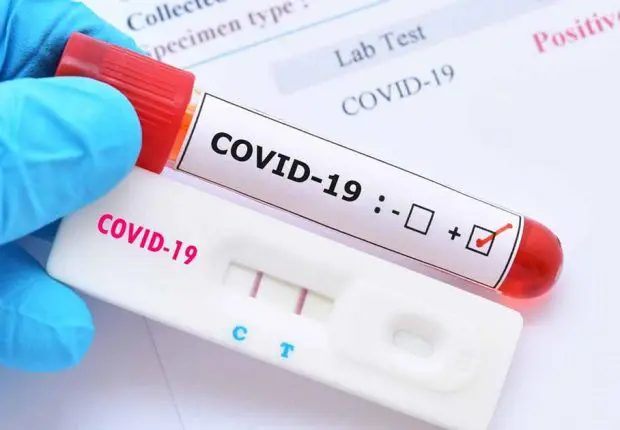 Bilan Covid-19 : légère hausse du nombre de cas ce mardi 13 décembre