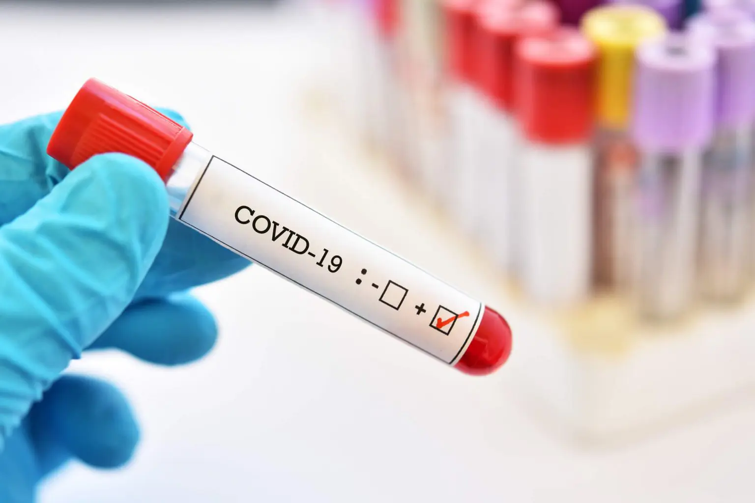 Bilan Covid-19 : la baisse du nombre de cas se poursuit ce 26 avril