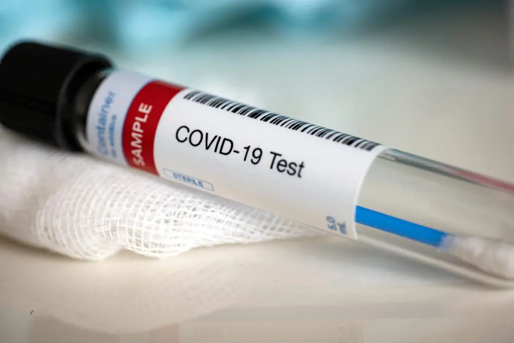 Covid-19 en Algérie : hausse du nombre de cas ce jeudi 24 novembre