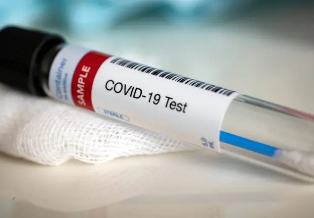 Covid-19 en Algérie : hausse du nombre de cas ce jeudi 24 novembre