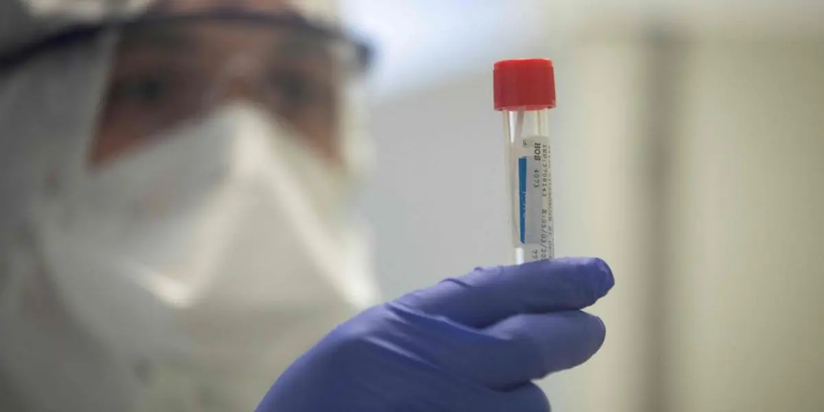 La variole du singe détectée en France et dans d&rsquo;autres pays européens