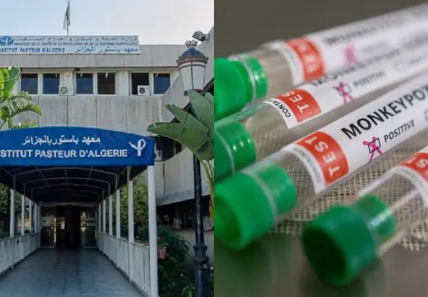 Variole du singe en Algérie : l’Institut Pasteur fait le point