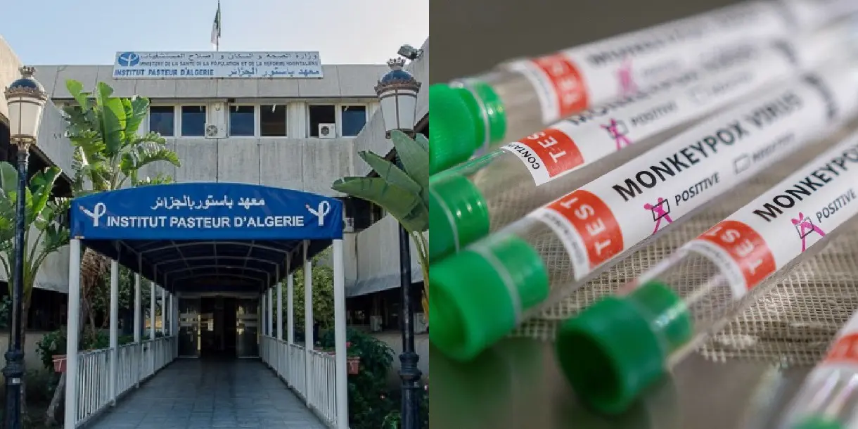 Variole du singe en Algérie : l’Institut Pasteur fait le point