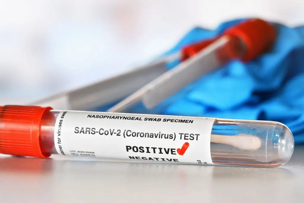 Covid-19 en Algérie : un bilan toujours en-dessous des 5 cas, ce 7 juin