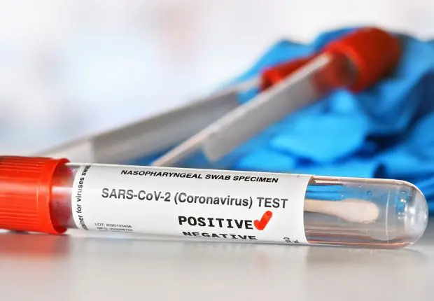 Covid-19 en Algérie : un bilan toujours en-dessous des 5 cas, ce 7 juin