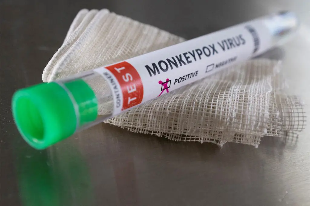 Variole du singe: le risque d’une pandémie est-il écarté ? L’OMS répond
