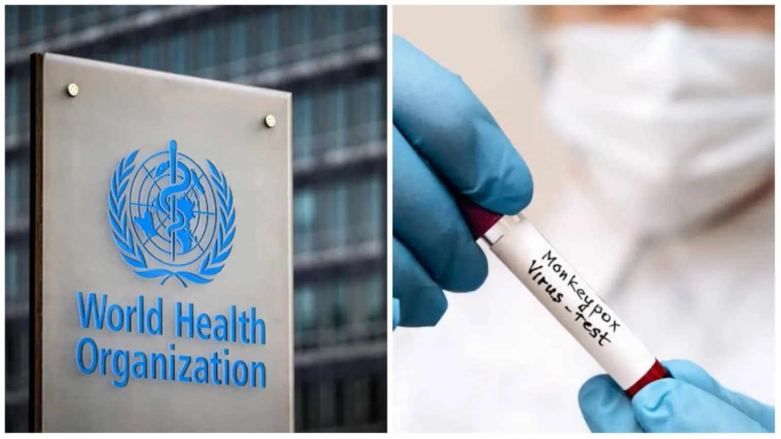 Variole du singe : l’OMS déclenche le plus haut niveau d’alerte