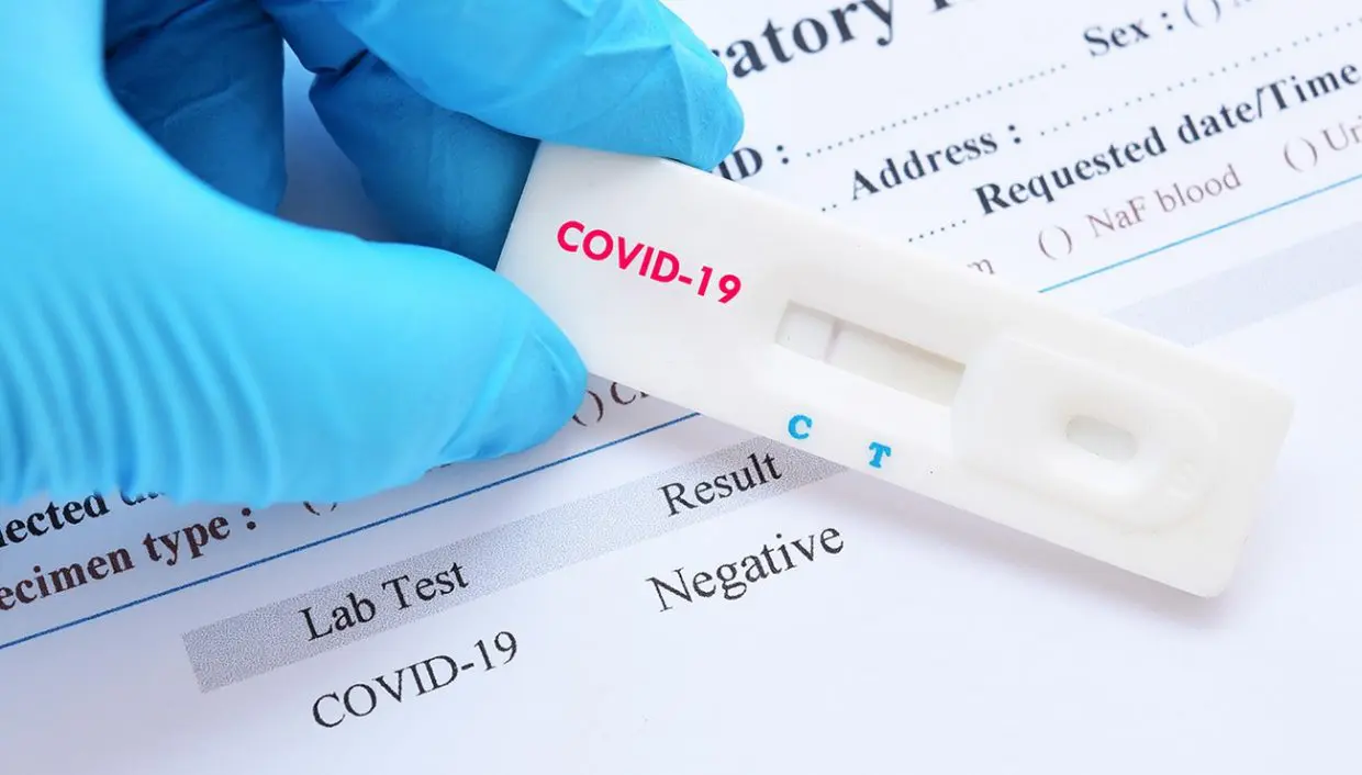 Bilan Covid-19 : très légère baisse du nombre de cas ce 19 décembre