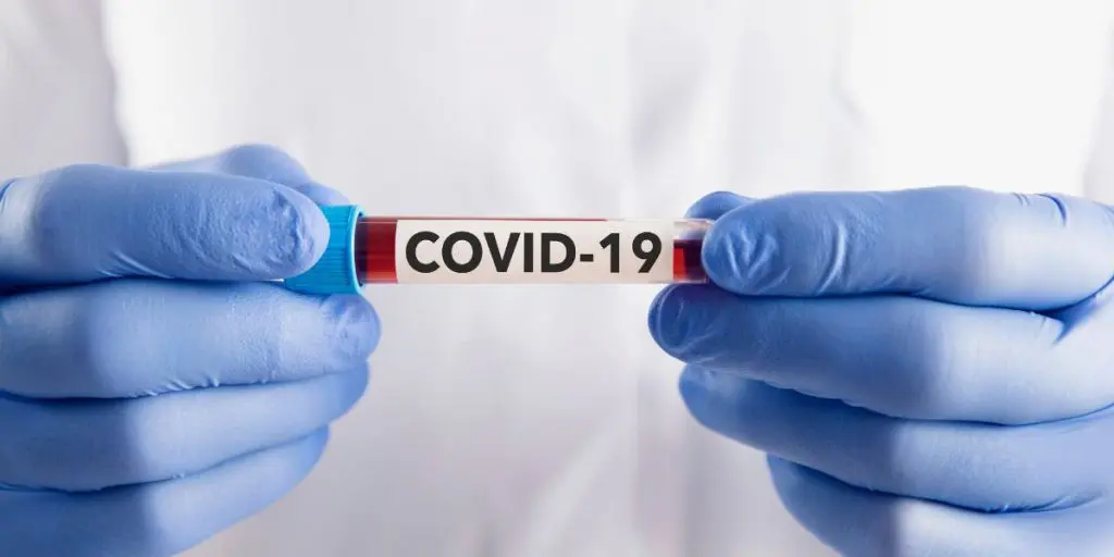 Covid-19 en Algérie : nouvelle baisse des contaminations ce 26 août