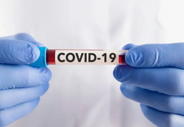 Covid-19 en Algérie : nouvelle baisse des contaminations ce 26 août