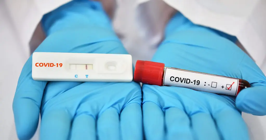 Covid-19 en Algérie : le nombre de cas repart à la baisse ce 6 aout