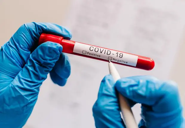 Covid-19 en Algérie : légère baisse des contaminations ce 30 aout