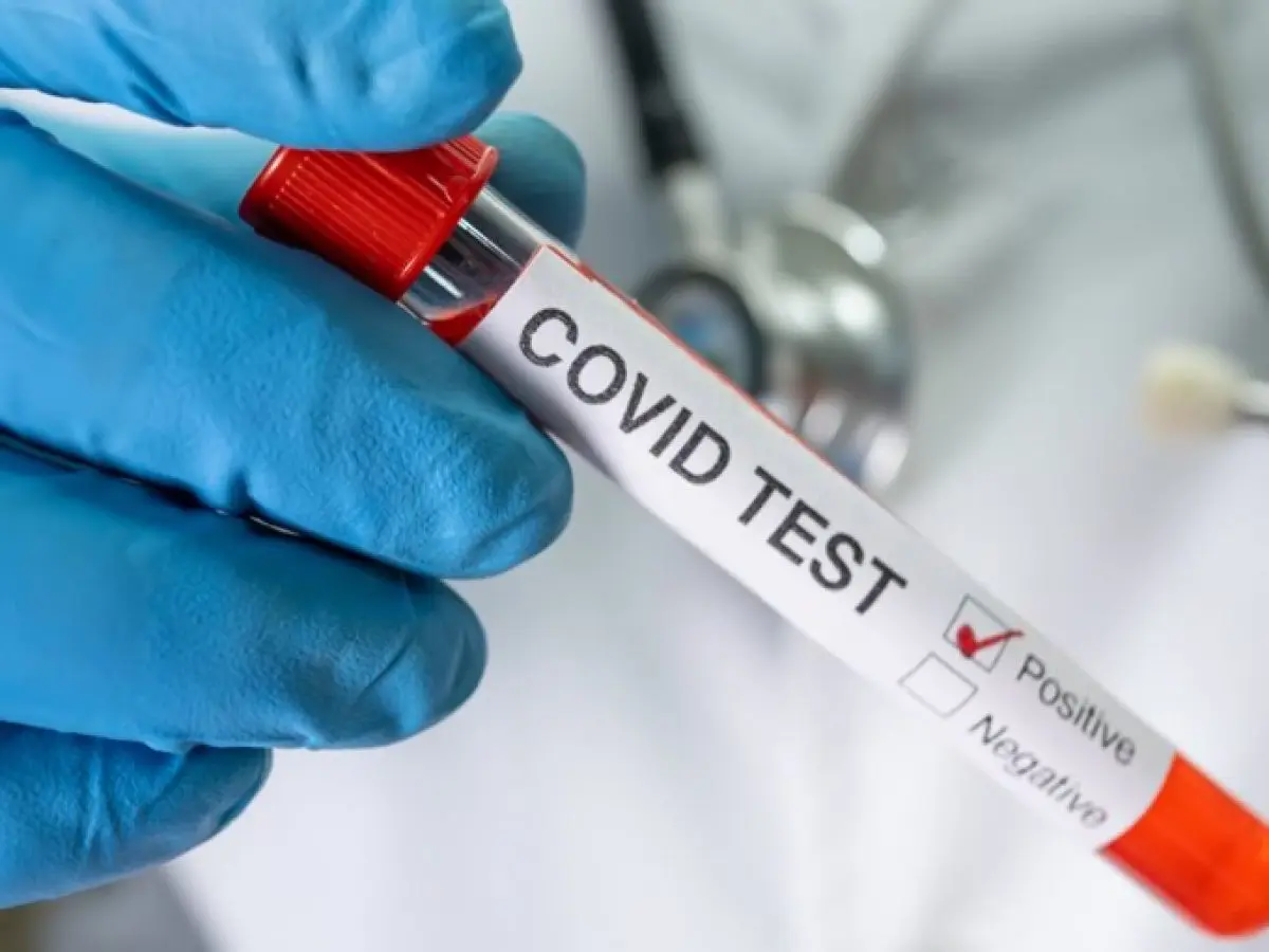 Covid-19 en Algérie : le bilan des contaminations pour ce 14 octobre