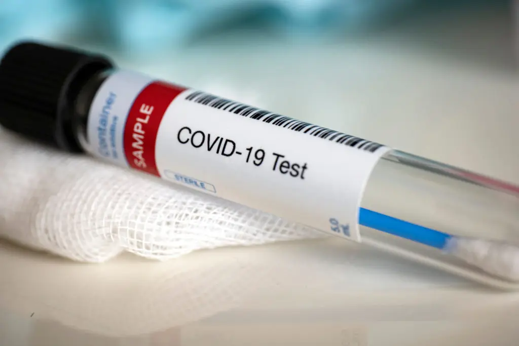 Covid-19 en Algérie : bilan des cas en légère baisse ce 1e décembre