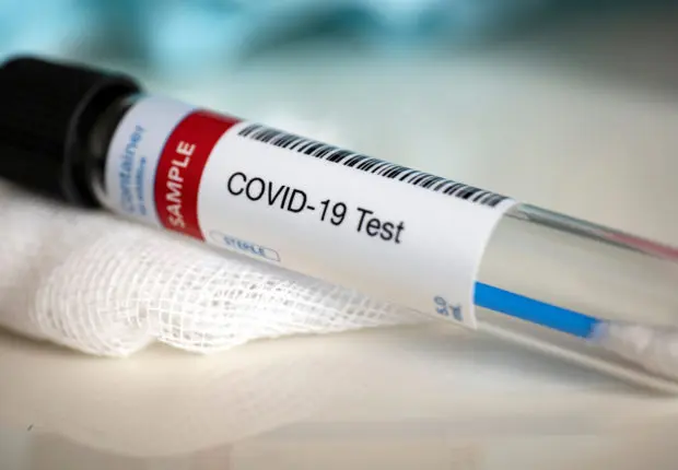 Covid-19 en Algérie : stagnation du nombre de cas ce 22 décembre