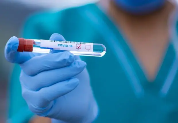 Covid-19 en Algérie : légère baisse des contaminations ce 25 novembre