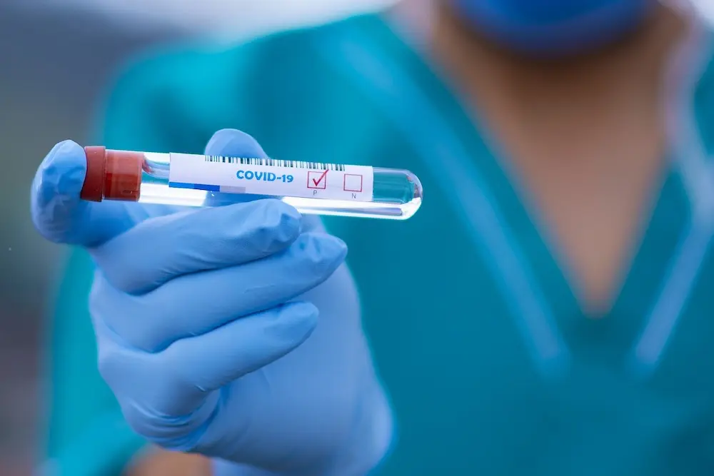 Bilan Covid-19 : le nombre de cas repart à la baisse ce 16 novembre