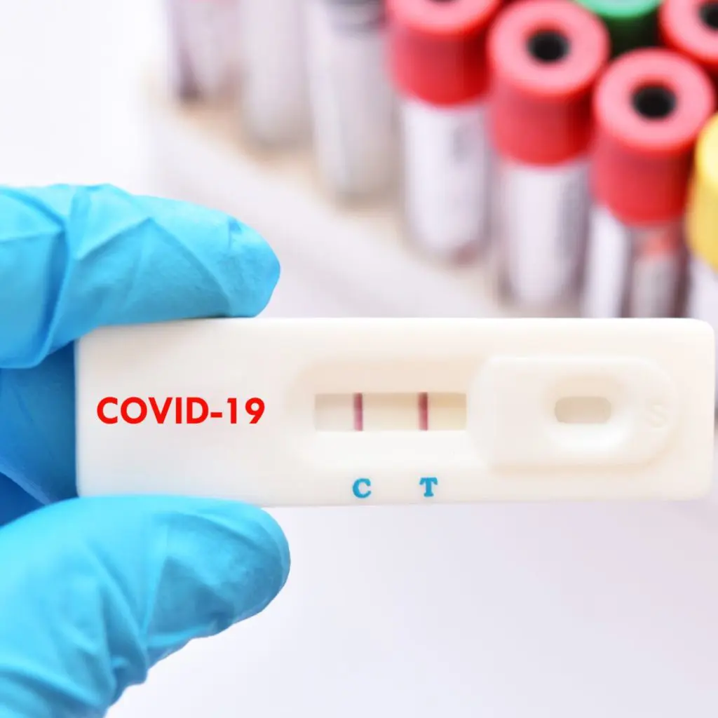 Covid-19 en Algérie : nouvelle baisse du nombre de cas ce 16 décembre