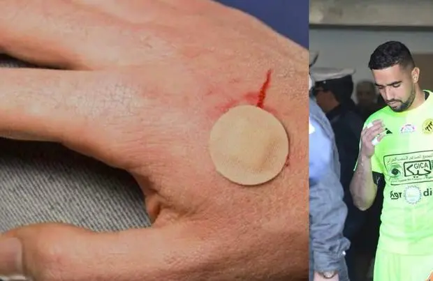 USMH : le gardien de but, Rebiai, lâchement agressé à l&rsquo;arme blanche