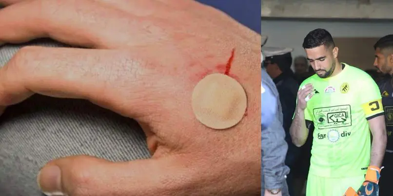 USMH : le gardien de but, Rebiai, lâchement agressé à l’arme blanche