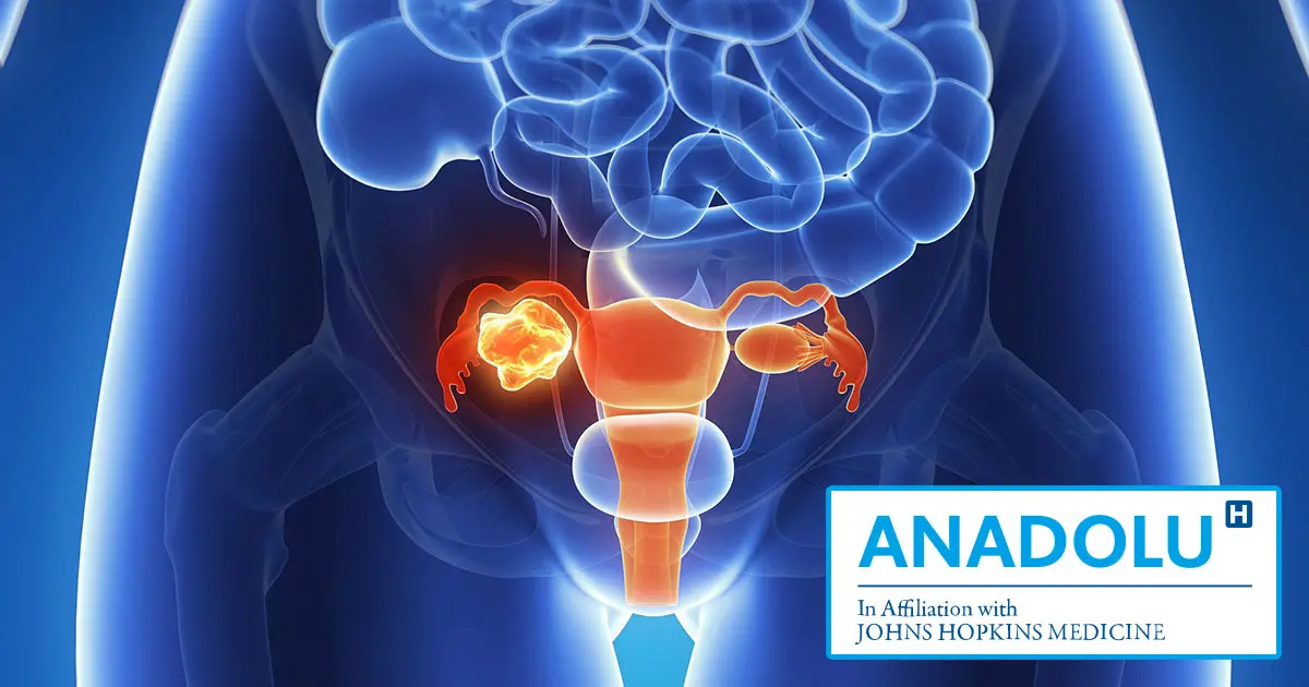 Cancer du col de l’utérus : symptômes, causes, et traitement au Centre Médical Anadolu